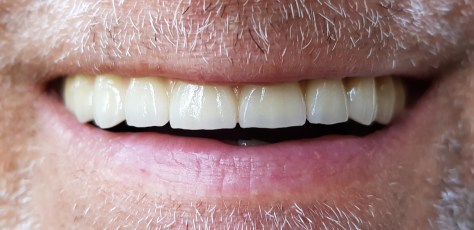 Screenshot_20200725-174424_Photos