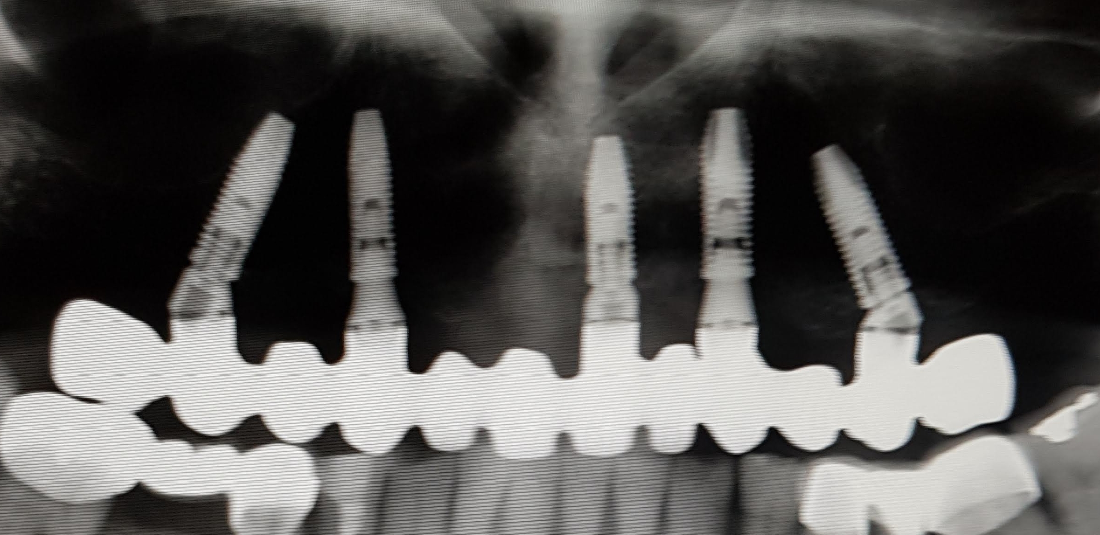 Screenshot_20200725-174809_Photos