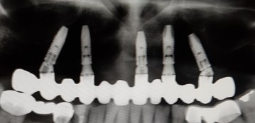 Screenshot_20200725-174809_Photos